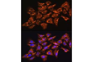 Immunofluorescence analysis of U-2 OS cells using GNB1 Rabbit pAb (ABIN6129389, ABIN6141219, ABIN6141220 and ABIN6219000) at dilution of 1:100 (40x lens).