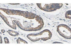 ABIN6279191 at 1/100 staining Human prostate tissue by IHC-P. (BAAT 抗体  (N-Term))