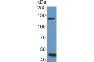 Detection of IRS1 in Rat Cerebrum lysate using Polyclonal Antibody to Insulin Receptor Substrate 1 (IRS1) (IRS1 抗体  (AA 837-1089))