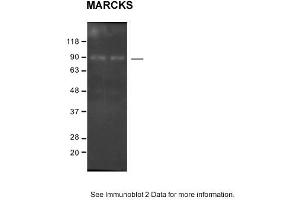 Sample: SH-SY5Y cells 2. (MARCKS 抗体  (C-Term))