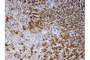 IHC analysis of PARK7 / DJ1 using anti-PARK7 / DJ1 antibody . (PARK7/DJ1 抗体  (AA 2-189))