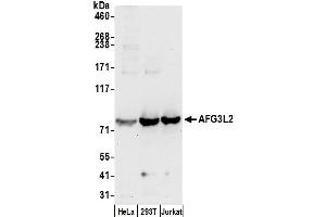 anti-AFG3-Like Protein 2 (AFG3L2) (AA 75-125) antibody