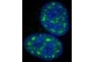 Immunofluorescence staining of HepG2 cells with ABIN7139623 at 1:100, counter-stained with DAPI. (Histone H1.5 抗体  (pThr154))
