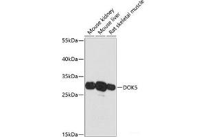 Western blot analysis of extracts of various cell lines using DOK5 Polyclonal Antibody at dilution of 1:3000. (DOK5 抗体)