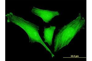 Immunofluorescence of monoclonal antibody to SLC2A4RG on HeLa cell. (SLC2A4RG 抗体  (AA 178-269))