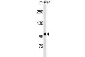 Western Blotting (WB) image for anti-Zinc Finger Protein 865 (ZNF865) antibody (ABIN5020901) (ZNF865 抗体)
