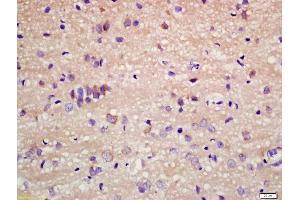 Formalin-fixed and paraffin embedded rat brain labeled with Anti-Staufen Polyclonal Antibody, Unconjugated (ABIN1385730) at 1:200 followed by conjugation to the secondary antibody and DAB staining
