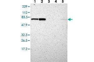 Western blot analysis of Lane 1: RT-4, Lane 2: U-251 MG, Lane 3: Human Plasma, Lane 4: Liver, Lane 5: Tonsil with RNGTT polyclonal antibody . (RNGTT 抗体)