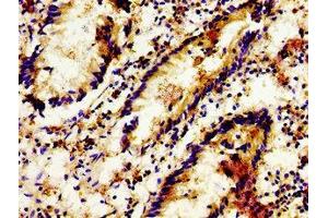 Immunohistochemistry of paraffin-embedded human appendix tissue using ABIN7158134 at dilution of 1:100 (LGR6 抗体  (AA 839-962))