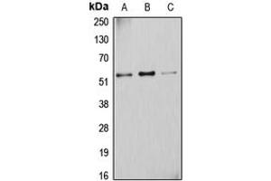 Western blot analysis of Cytochrome P450 2D6 expression in A431 (A), K562 (B), HuvEc (C) whole cell lysates. (CYP2D6 抗体  (N-Term))