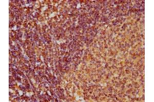 IHC image of ABIN7145992 diluted at 1:100 and staining in paraffin-embedded human lymph node tissue performed on a Leica BondTM system. (CCL27 抗体  (AA 25-112))