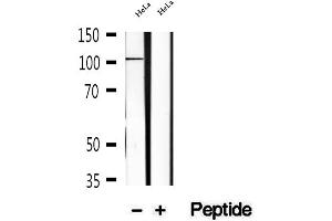 Western blot analysis of extracts of HeLa cells, using KIF18A antibody. (KIF18A 抗体  (Internal Region))