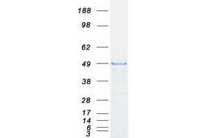 Western Blotting (WB) image for Zinc Finger, FYVE Domain Containing 27 (ZFYVE27) (Transcript Variant 2) protein (Myc-DYKDDDDK Tag) (ABIN2735873)