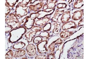 Paraformaldehyde-fixed, paraffin embedded human kidney tissue, Antigen retrieval by boiling in sodium citrate buffer(pH6) for 15min, Block endogenous peroxidase by 3% hydrogen peroxide for 30 minutes, Blocking buffer (normal goat serum) at 37°C for 20min, Antibody incubation with Rabbit Anti-PKR(Thr451) Polyclonal Antibody, Unconjugated  at 1:500 overnight at 4°C, followed by a conjugated secondary and DAB staining (EIF2AK2 抗体  (pThr451))