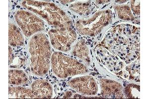 Immunohistochemical staining of paraffin-embedded Human Kidney tissue using anti-AGPAT5 mouse monoclonal antibody. (AGPAT5 抗体)