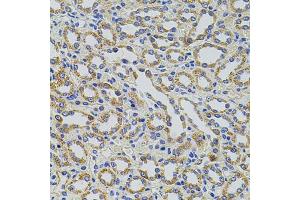 Immunohistochemistry of paraffin-embedded rat kidney using TRMT2A antibody (ABIN1877004) at dilution of 1:100 (40x lens). (TRMT2A 抗体)