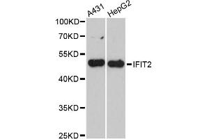 Western blot analysis of extracts of various cell lines, using IFIT2 antibody (ABIN6293343) at 1:3000 dilution. (IFIT2 抗体)
