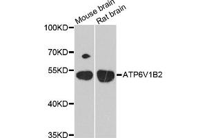 Western blot analysis of extracts of mouse brain and rat brain cell lines, using ATP6V1B2 antibody. (ATP6V1B2 抗体)