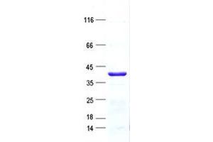 Western Blotting (WB) image for Zinc Finger Protein 396 (ZNF396) protein (His tag) (ABIN5505807)