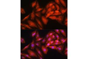 Immunofluorescence analysis of H9C2 cells using EXOSC2 Rabbit pAb (ABIN6127886, ABIN6140374, ABIN6140375 and ABIN6214708) at dilution of 1:100. (EXOSC2 抗体  (AA 1-293))