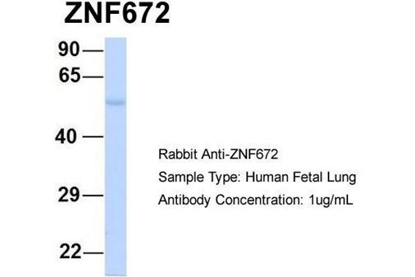 ZNF672 抗体  (Middle Region)