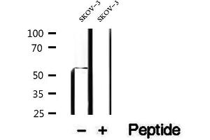 Western blot analysis of extracts of SKOV-3 cells, using PDHX antibody. (PDHX 抗体)