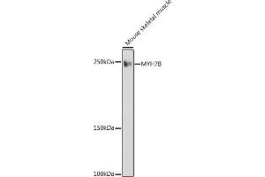 Western blot analysis of extracts of Mouse skeletal muscle, using MYH7B antibody (ABIN7268759) at 1:1000 dilution. (MYH7B 抗体)