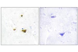 Immunohistochemistry analysis of paraffin-embedded human brain tissue, using EZH1 antibody. (EZH1 抗体  (Internal Region))