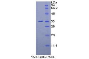 SDS-PAGE (SDS) image for Histidine Decarboxylase (HDC) (AA 365-643) protein (His tag) (ABIN1879017) (HDC Protein (AA 365-643) (His tag))