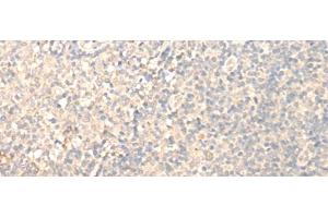 Immunohistochemistry of paraffin-embedded Human tonsil tissue using MRPL1 Polyclonal Antibody at dilution of 1:25(x200) (MRPL1 抗体)