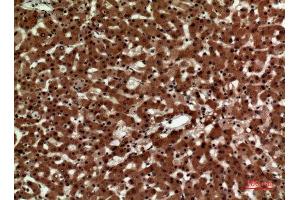Immunohistochemistry (IHC) analysis of paraffin-embedded Human Liver, antibody was diluted at 1:100. (IL12A 抗体  (Internal Region))