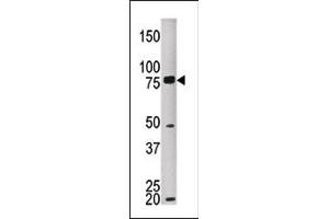 The anti-MELK Pab (ABIN391224 and ABIN2841298) is used in Western blot to detect MKEL in HEPG2 tissue lysate (MELK 抗体  (C-Term))
