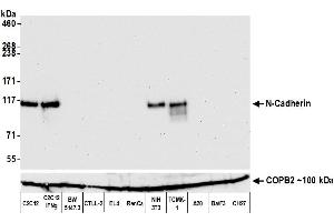 Western Blotting (WB) image for anti-Cadherin 2 (CDH2) (AA 160-724) antibody (ABIN7453333)