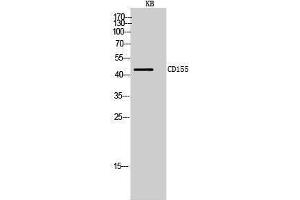 Western Blotting (WB) image for anti-Poliovirus Receptor (PVR) (Internal Region) antibody (ABIN3181466)