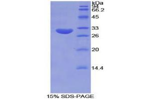 SDS-PAGE analysis of Mouse Tubulin epsilon Protein. (TUBE1 蛋白)