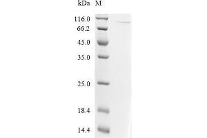 (Tris-Glycine gel) Discontinuous SDS-PAGE (reduced) with 5 % enrichment gel and 15 % separation gel.