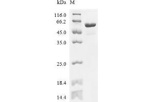 (Tris-Glycine gel) Discontinuous SDS-PAGE (reduced) with 5 % enrichment gel and 15 % separation gel.