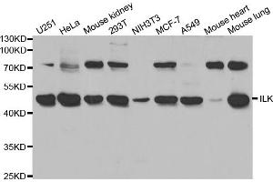 Western blot analysis of extracts of various cell lines, using ILK antibody (ABIN5970329) at 1/1000 dilution. (ILK 抗体)