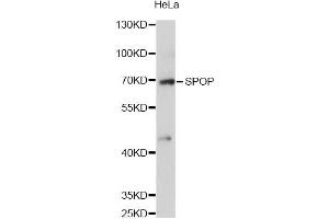 Western blot analysis of extracts of HeLa cells, using SPOP antibody (ABIN6292286) at 1:3000 dilution.