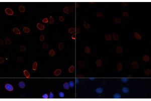 Immunofluorescence analysis of C6 cells using Acetyl-Histone H3-K56 Polyclonal Antibody at dilution of 1:100. (Histone 3 抗体  (acLys56))