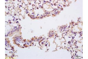 Immunohistochemistry (IHC) image for anti-Neurotrophic Tyrosine Kinase, Receptor, Type 1 (NTRK1) (pTyr496) antibody (ABIN746603)