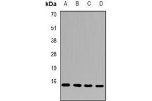 Western blot analysis of FAM96B expression in Hela (A), MCF7 (B), mouse heart (C), mouse testis (D) whole cell lysates. (FAM96B 抗体)