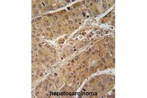 Immunohistochemistry (IHC) image for anti-Ribosomal Protein S6 Kinase, 70kDa, Polypeptide 2 (RPS6KB2) antibody (ABIN2909954) (RPS6KB2 抗体)
