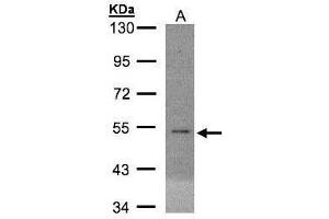WB Image Sample(30 ug whole cell lysate) A:MOLT4 , 10% SDS PAGE antibody diluted at 1:3000 (EIF5 抗体)