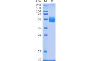 Human NKp30 Protein, hFc Tag on SDS-PAGE under reducing condition.