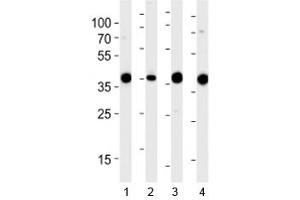 Western blot analysis of lysate from 1) 293, 2) RD, 3) mouse NIH3T3 and 4) rat L6 cell line using Aldolase antibody at 1:1000. (ALDOA 抗体  (AA 66-95))