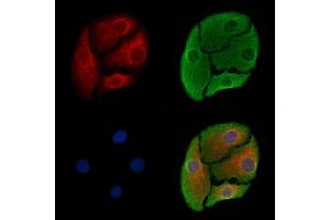 ABIN6265683 and ABIN6278367 staining Hela cells by IF/ICC.