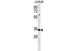 TRNAU1 Antibody (Center) 18294c western blot analysis in Jurkat cell line lysates (35 μg/lane). (TRNAU1AP 抗体  (AA 160-186))