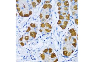 Immunohistochemistry (IHC) image for anti-Polymerase (DNA Directed), beta (POLB) (AA 1-335) antibody (ABIN3022385)