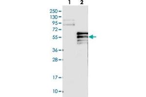 Western blot analysis of Lane 1: Negative control (vector only transfected HEK293T lysate), Lane 2: Over-expression Lysate (Co-expressed with a C-terminal myc-DDK tag (~3. (PI4K2B 抗体)